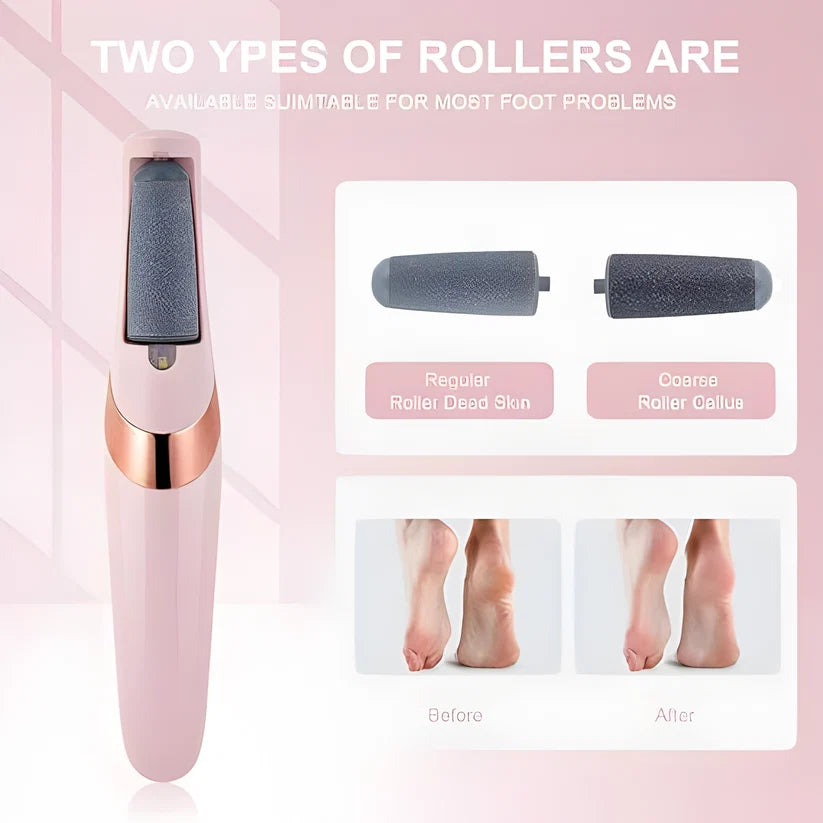 USB Rechargeable Foot Callus Remover – Electric File with LED Light & 2-Speed Settings for Smooth Feet